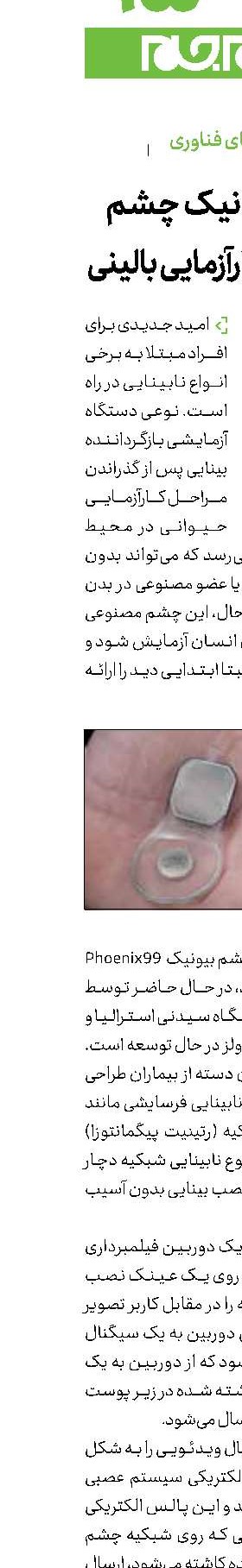 پروتز بیونیک چشم در مسیر کارآزمایی بالینی