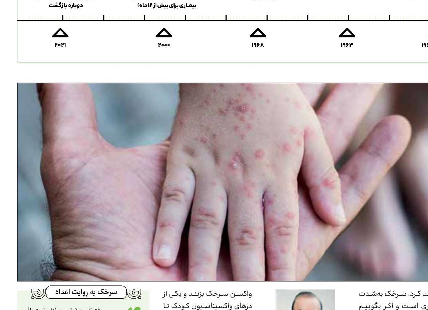 خطر شیوع سرخک
