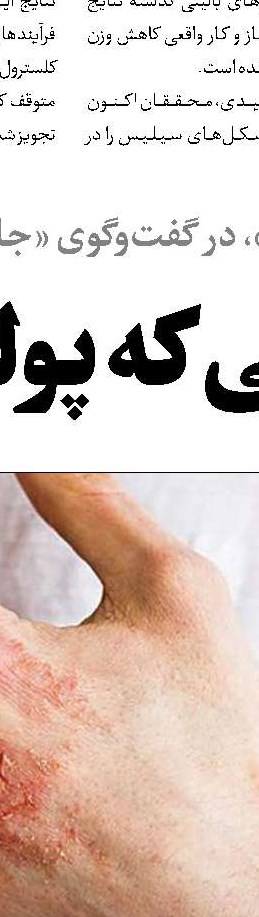 این موخوره‌های چندشاخه