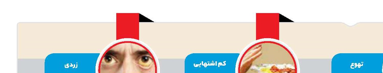 چهار علامت احتمالی کبد چرب